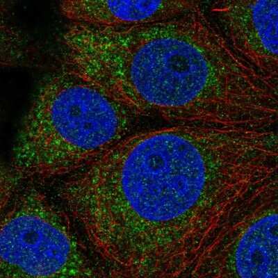 Immunocytochemistry/ Immunofluorescence: QTRT1 Antibody [NBP2-59021]