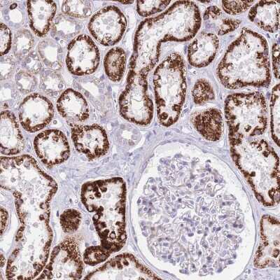 Immunohistochemistry-Paraffin: QTRT1 Antibody [NBP2-48911]