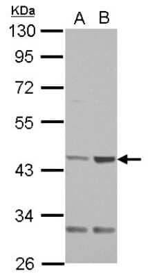 Western Blot: QTRT1 Antibody [NBP2-20030]