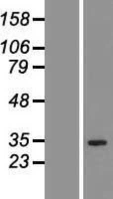 Western Blot: QTRT1 Overexpression Lysate [NBP2-06145]