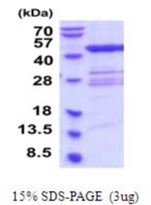 SDS-PAGE: Recombinant Human QTRT1 His Protein [NBP2-52102]