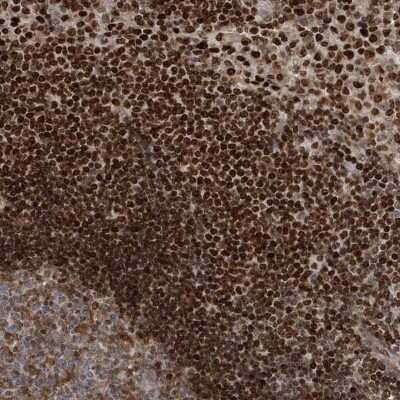 Immunohistochemistry: QTRTD1 Antibody [NBP2-32674]