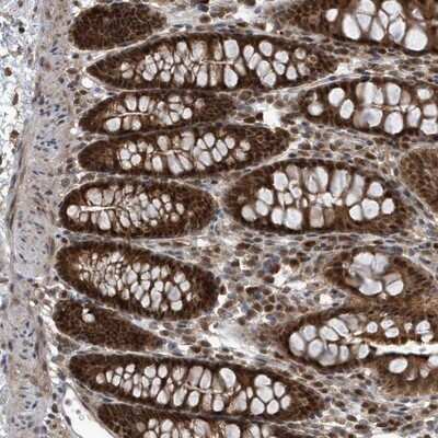 Immunohistochemistry-Paraffin: QTRTD1 Antibody [NBP1-83706]