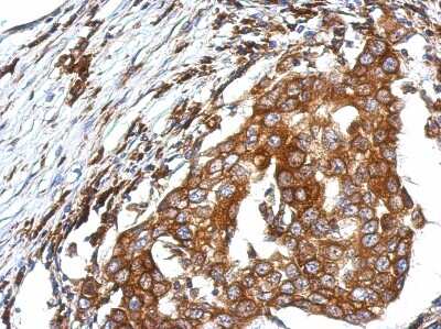 Immunohistochemistry-Paraffin: QTRTD1 Antibody [NBP2-20031]