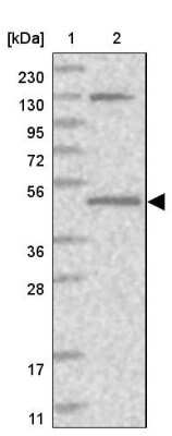 Western Blot: QTRTD1 Antibody [NBP1-83706]