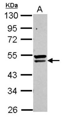 Western Blot: QTRTD1 Antibody [NBP2-20031]