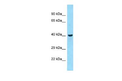 Western Blot: QTRTD1 Antibody [NBP3-09264]