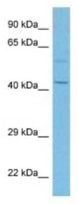 Western Blot: QTRTD1 Antibody [NBP3-10057]