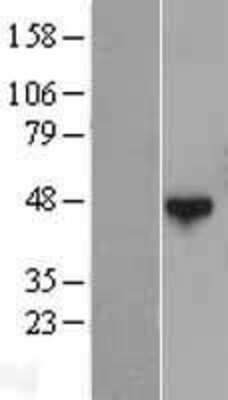 Western Blot: QTRTD1 Overexpression Lysate [NBL1-15035]