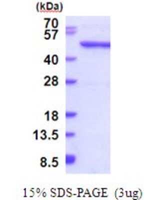 SDS-PAGE: Recombinant Human QTRTD1 His Protein [NBP2-51878]