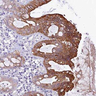 Immunohistochemistry: QSOX1/Quiescin Q6 Antibody [NBP2-13836]