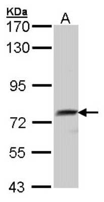 Western Blot: QSOX1/Quiescin Q6 Antibody [NBP1-33198]