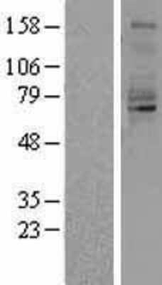 Western Blot: QSOX1/Quiescin Q6 Overexpression Lysate [NBL1-15033]