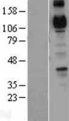 Western Blot: Cadherin-4/R-Cadherin Overexpression Lysate [NBL1-09033]