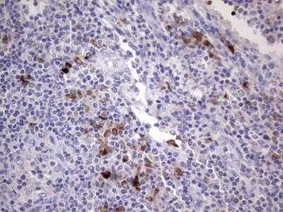 Immunohistochemistry: R-Spondin 1 Antibody (OTI11A9) [NBP2-45636]