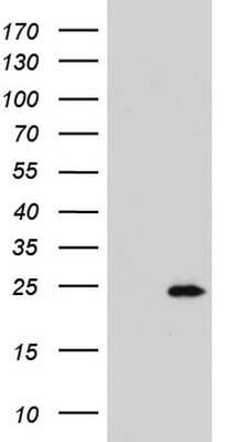 Western Blot: R-Spondin 1 Antibody (OTI11A9) [NBP2-45636]