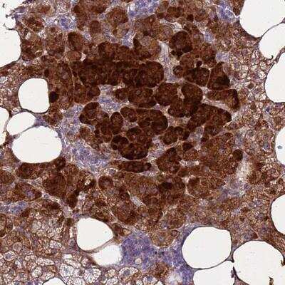 Immunohistochemistry-Paraffin: R-Spondin 1 Antibody [NBP1-92357]