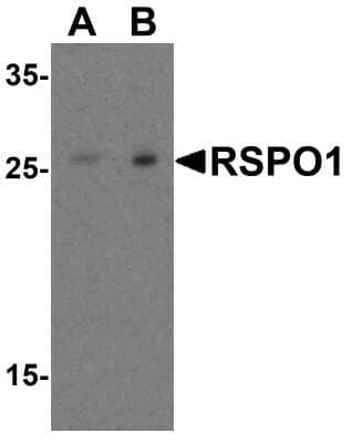 Western Blot: R-Spondin 1 AntibodyBSA Free [NBP1-77354]