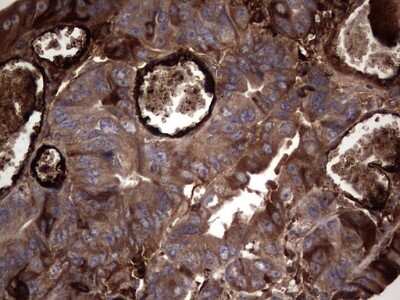 Immunohistochemistry: R-Spondin 3 Antibody (OTI3D5) [NBP2-45637]