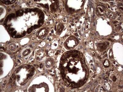 Immunohistochemistry: R-Spondin 3 Antibody (OTI3D5) [NBP2-45637]