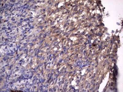 Immunohistochemistry: R-Spondin 3 Antibody (OTI3D5) [NBP2-45637]