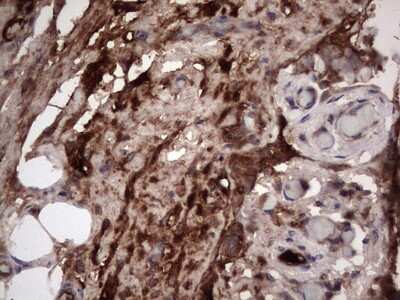 Immunohistochemistry: R-Spondin 3 Antibody (OTI3D5) [NBP2-45637]