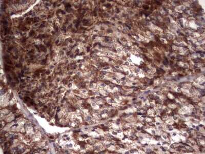 Immunohistochemistry: R-Spondin 3 Antibody (OTI3D5) [NBP2-45637]