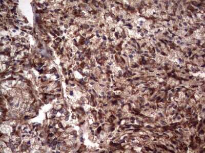 Immunohistochemistry: R-Spondin 3 Antibody (OTI3D5) [NBP2-45637]