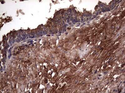 Immunohistochemistry: R-Spondin 3 Antibody (OTI3D5) [NBP2-45637]