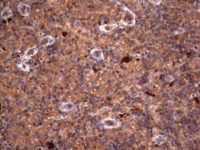 Immunohistochemistry: R-Spondin 3 Antibody (OTI3D5) [NBP2-45637]