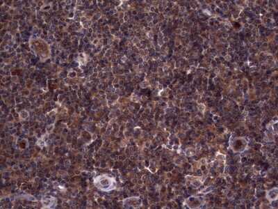 Immunohistochemistry: R-Spondin 3 Antibody (OTI3D5) [NBP2-45637]