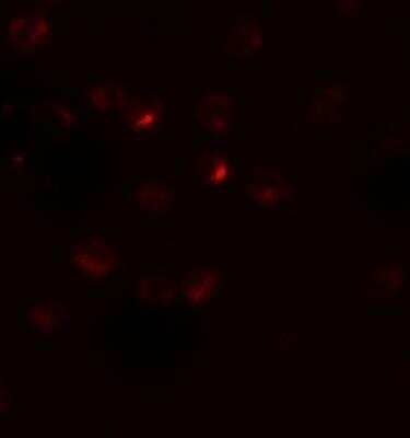 Immunocytochemistry/ Immunofluorescence: R-Spondin 3 Antibody - BSA Free [NBP2-81849]