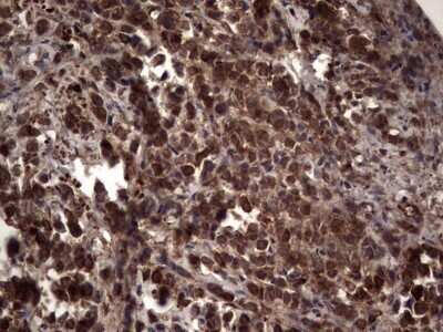 Immunohistochemistry: R-Spondin 3 Antibody (OTI3D5) - Azide and BSA Free [NBP2-73949]