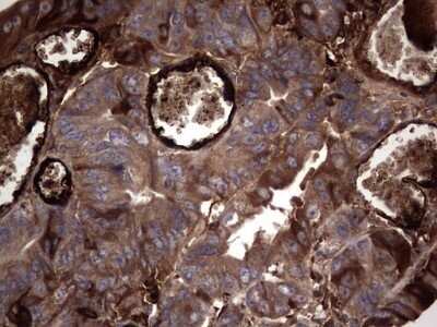 Immunohistochemistry: R-Spondin 3 Antibody (OTI3D5) - Azide and BSA Free [NBP2-73949]