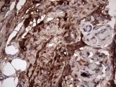 Immunohistochemistry: R-Spondin 3 Antibody (OTI3D5) - Azide and BSA Free [NBP2-73949]