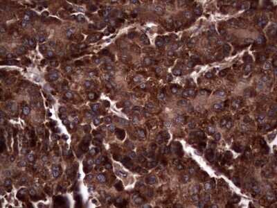 Immunohistochemistry: R-Spondin 3 Antibody (OTI3D5) - Azide and BSA Free [NBP2-73949]