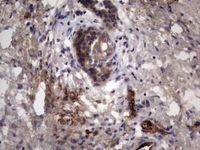 Immunohistochemistry: R-Spondin 3 Antibody (OTI3D5) - Azide and BSA Free [NBP2-73949]