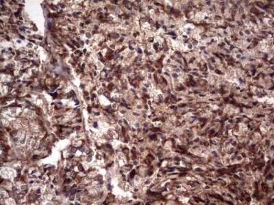 Immunohistochemistry: R-Spondin 3 Antibody (OTI3D5) - Azide and BSA Free [NBP2-73949]