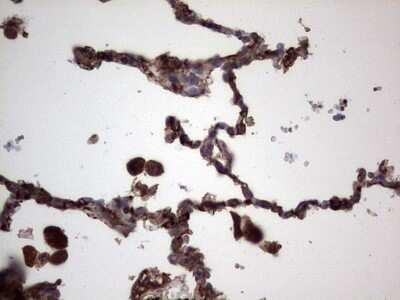 Immunohistochemistry: R-Spondin 3 Antibody (OTI3D5) - Azide and BSA Free [NBP2-73949]