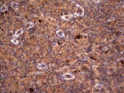 Immunohistochemistry: R-Spondin 3 Antibody (OTI3D5) - Azide and BSA Free [NBP2-73949]