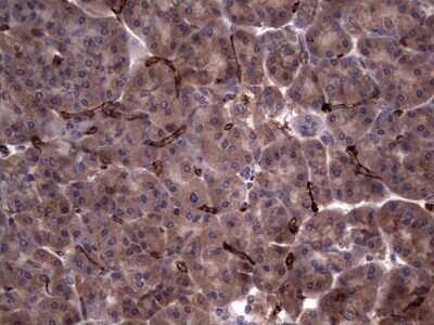 Immunohistochemistry: R-Spondin 3 Antibody (OTI3D5) - Azide and BSA Free [NBP2-73949]
