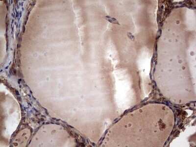 Immunohistochemistry: R-Spondin 3 Antibody (OTI3D5) - Azide and BSA Free [NBP2-73949]