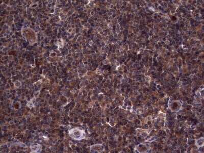 Immunohistochemistry: R-Spondin 3 Antibody (OTI3D5) - Azide and BSA Free [NBP2-73949]
