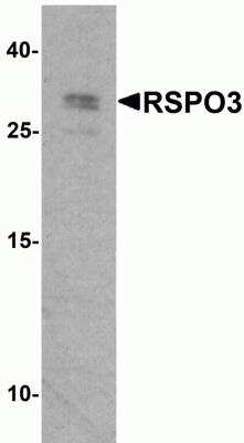 Western Blot: R-Spondin 3 AntibodyBSA Free [NBP2-81849]