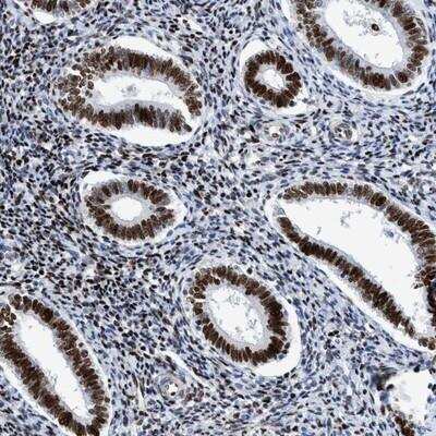 Immunohistochemistry: R3HCC1 Antibody [NBP1-90528]