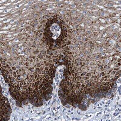 Immunohistochemistry-Paraffin: R3HCC1 Antibody [NBP1-90527]