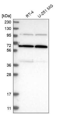 Western Blot: R3HCC1 Antibody [NBP1-90527]