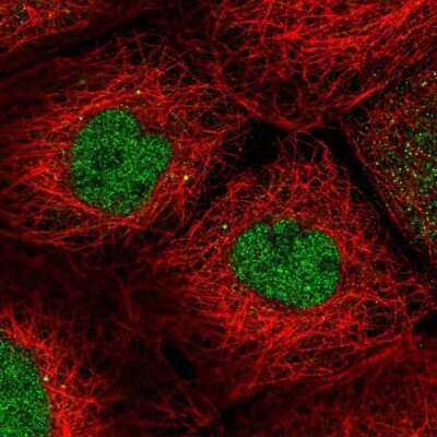 Immunocytochemistry/ Immunofluorescence: R3HDM2 Antibody [NBP2-38405]