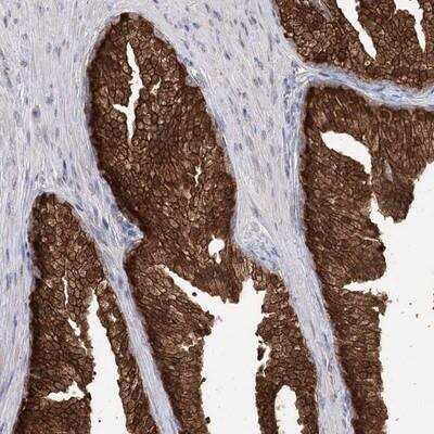 Immunohistochemistry-Paraffin: R3HDM2 Antibody [NBP1-81448]