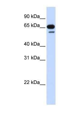 Western Blot: R3HDM2 Antibody [NBP1-56775]